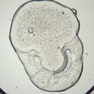 protein crystals captured in lipidic cubic phase