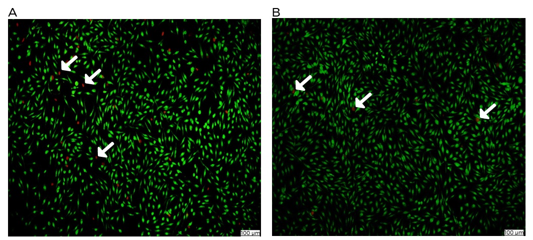 AO EB Staining